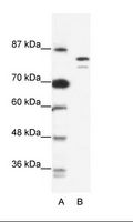 MCM8 Antibody - A: Marker, B: Jurkat Cell Lysate.  This image was taken for the unconjugated form of this product. Other forms have not been tested.