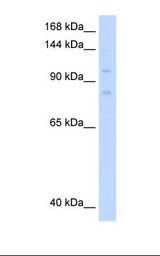 MCM8 Antibody - 721_B cell lysate. Antibody concentration: 0.5 ug/ml. Gel concentration: 8%.  This image was taken for the unconjugated form of this product. Other forms have not been tested.