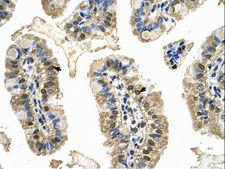 MCM8 Antibody - MCM8 antibody MCM8(minichromosome maintenance complex component 8) Antibody was used in IHC to stain formalin-fixed, paraffin-embedded human intestine.  This image was taken for the unconjugated form of this product. Other forms have not been tested.