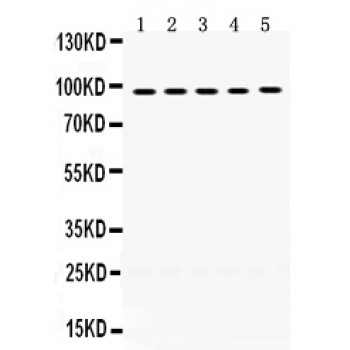 MCM8 Antibody - MCM8 antibody Western blot. All lanes: Anti MCM8 at 0.5 ug/ml. Lane 1: A549 Whole Cell Lysate at 40 ug. Lane 2: SW620 Whole Cell Lysate at 40 ug. Lane 3: HELA Whole Cell Lysate at 40 ug. Lane 4: PANC Whole Cell Lysate at 40 ug. Lane 5: HEPG2 Whole Cell Lysate at 40 ug. Predicted band size: 94 kD. Observed band size: 94 kD.