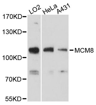 MCM8 Antibody - Western blot analysis of extracts of various cell lines, using MCM8 antibody at 1:3000 dilution. The secondary antibody used was an HRP Goat Anti-Rabbit IgG (H+L) at 1:10000 dilution. Lysates were loaded 25ug per lane and 3% nonfat dry milk in TBST was used for blocking. An ECL Kit was used for detection and the exposure time was 30s.