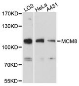 MCM8 Antibody - Western blot analysis of extracts of various cell lines, using MCM8 antibody at 1:3000 dilution. The secondary antibody used was an HRP Goat Anti-Rabbit IgG (H+L) at 1:10000 dilution. Lysates were loaded 25ug per lane and 3% nonfat dry milk in TBST was used for blocking. An ECL Kit was used for detection and the exposure time was 30s.