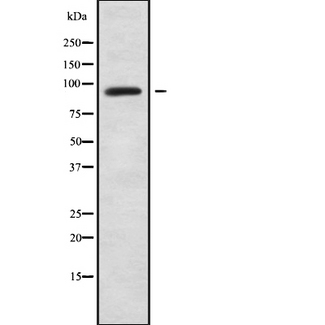 MCM8 Antibody - Western blot analysis of MCM8 using COLO205 whole cells lysates
