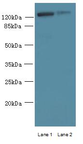 MCM9 Antibody - Western blot. All lanes: MCM9 antibody at 0.8 ug/ml. Lane 1: Mouse brain tissue. Lane 2: 293T whole cell lysate. Secondary Goat polyclonal to Rabbit IgG at 1:10000 dilution. Predicted band size: 127 kDa. Observed band size: 127 kDa.