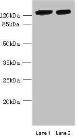 MCM9 Antibody - Western blot All lanes: MCM9 antibody at 0.8µg/ml Lane 1: Mouse brain tissue Lane 2: 293T whole cell lysate Secondary Goat polyclonal to rabbit IgG at 1/10000 dilution Predicted band size: 128, 73, 44, 85 kDa Observed band size: 128 kDa