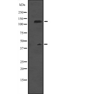 MCM9 Antibody - Western blot analysis of MCM9 expression in rat brain tissue lysate. The lane on the left is treated with the antigen-specific peptide.