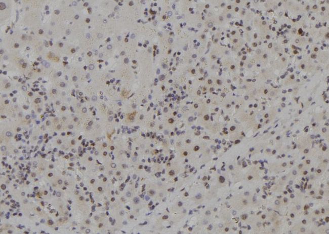 MCM9 Antibody - 1:100 staining human liver tissue by IHC-P. The sample was formaldehyde fixed and a heat mediated antigen retrieval step in citrate buffer was performed. The sample was then blocked and incubated with the antibody for 1.5 hours at 22°C. An HRP conjugated goat anti-rabbit antibody was used as the secondary.