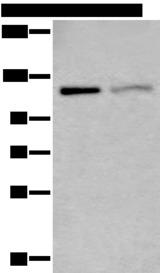 MCM9 Antibody - Western blot analysis of K562 and 231 cell lysates  using MCM9 Polyclonal Antibody at dilution of 1:800