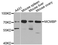 MCMBP / C10orf119 Antibody - Western blot analysis of extract of various cells.