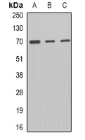 MCMBP / C10orf119 Antibody - Western blot analysis of MCM-BP expression in A431 (A); mouse spleen (B); mouse liver (C) whole cell lysates.