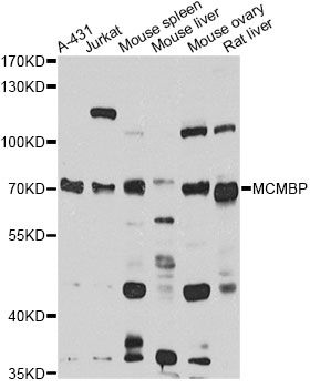MCMBP / C10orf119 Antibody - Western blot analysis of extracts of various cell lines, using MCMBP antibody at 1:1000 dilution. The secondary antibody used was an HRP Goat Anti-Rabbit IgG (H+L) at 1:10000 dilution. Lysates were loaded 25ug per lane and 3% nonfat dry milk in TBST was used for blocking. An ECL Kit was used for detection and the exposure time was 60s.