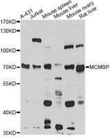 MCMBP / C10orf119 Antibody - Western blot analysis of extracts of various cell lines, using MCMBP antibody at 1:1000 dilution. The secondary antibody used was an HRP Goat Anti-Rabbit IgG (H+L) at 1:10000 dilution. Lysates were loaded 25ug per lane and 3% nonfat dry milk in TBST was used for blocking. An ECL Kit was used for detection and the exposure time was 60s.
