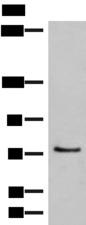 MCMBP / C10orf119 Antibody - Western blot analysis of 293T cell lysate  using MCMBP Polyclonal Antibody at dilution of 1:800