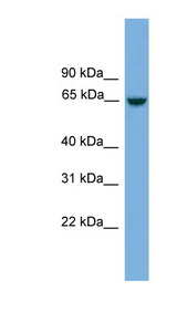 MCMDC2 / C8orf45 Antibody - C8orf45 antibody Western blot of Jurkat lysate. This image was taken for the unconjugated form of this product. Other forms have not been tested.