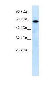 MCOLN1 / Mucolipin 1 Antibody - MCOLN1 / Mucolipin 1 antibody Western blot of Jurkat lysate. This image was taken for the unconjugated form of this product. Other forms have not been tested.