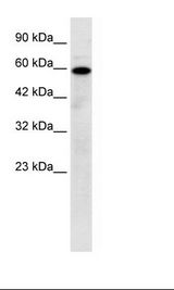 MCOLN1 / Mucolipin 1 Antibody - Jurkat Cell Lysate.  This image was taken for the unconjugated form of this product. Other forms have not been tested.