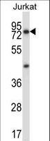 MCOLN1 / Mucolipin 1 Antibody - MCOLN1 Antibody western blot of Jurkat cell line lysates (35 ug/lane). The MCOLN1 antibody detected the MCOLN1 protein (arrow).