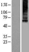 MCOLN1 / Mucolipin 1 Protein - Western validation with an anti-DDK antibody * L: Control HEK293 lysate R: Over-expression lysate