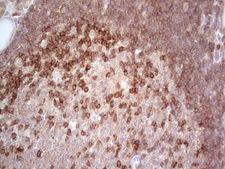 MCPH1 Antibody - Immunohistochemical staining of paraffin-embedded Human thyroid tissue within the normal limits using anti-MCPH1 mouse monoclonal antibody. (Heat-induced epitope retrieval by 1 mM EDTA in 10mM Tris, pH8.5, 120C for 3min,