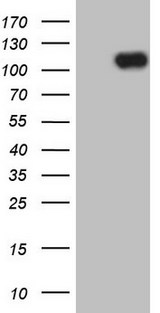 MCPH1 Antibody - HEK293T cells were transfected with the pCMV6-ENTRY control (Left lane) or pCMV6-ENTRY MCPH1 (Right lane) cDNA for 48 hrs and lysed. Equivalent amounts of cell lysates (5 ug per lane) were separated by SDS-PAGE and immunoblotted with anti-MCPH1.
