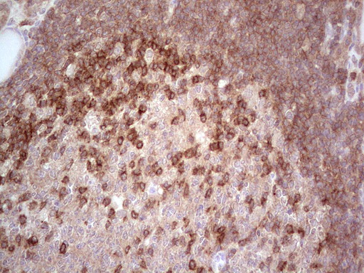MCPH1 Antibody - IHC of paraffin-embedded Human thyroid tissue using anti-MCPH1 mouse monoclonal antibody. (Heat-induced epitope retrieval by 1 mM EDTA in 10mM Tris, pH8.5, 120°C for 3min).