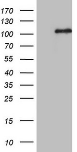 MCPH1 Antibody - HEK293T cells were transfected with the pCMV6-ENTRY control (Left lane) or pCMV6-ENTRY MCPH1 (Right lane) cDNA for 48 hrs and lysed. Equivalent amounts of cell lysates (5 ug per lane) were separated by SDS-PAGE and immunoblotted with anti-MCPH1.