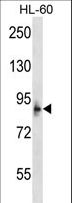 MCPH1 Antibody - MCPH1 Antibody western blot of HL-60 cell line lysates (35 ug/lane). The MCPH1 antibody detected the MCPH1 protein (arrow).