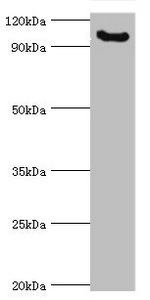 MCPH1 Antibody - Western blot All lanes: Microcephalin antibody at 3µg/ml + Mouse liver tissue Secondary Goat polyclonal to rabbit IgG at 1/10000 dilution Predicted band size: 93, 63, 68 kDa Observed band size: 93 kDa