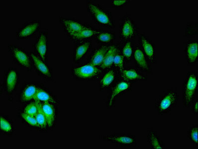 MCPH1 Antibody - Immunofluorescent analysis of Hela cells using MCPH1 Antibody at dilution of 1:100 and Alexa Fluor 488-congugated AffiniPure Goat Anti-Rabbit IgG(H+L)