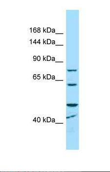 MCPH1 Antibody - Western blot of Human Hela. MCPH1 antibody dilution 1.0 ug/ml.  This image was taken for the unconjugated form of this product. Other forms have not been tested.