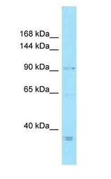 MCPH1 Antibody - MCPH1 / MCT antibody Western Blot of HeLa.  This image was taken for the unconjugated form of this product. Other forms have not been tested.