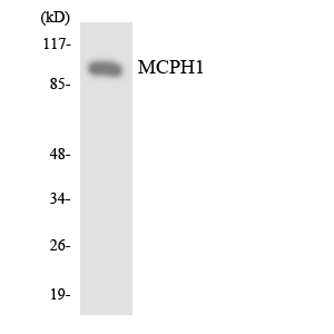 MCPH1 Antibody - Western blot analysis of the lysates from HT-29 cells using MCPH1 antibody.