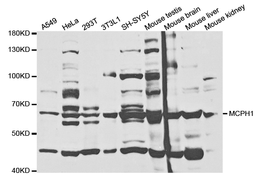 MCPH1 Antibody - Western blot analysis of extracts of various cell lines.