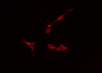MCPH1 Antibody - Staining HeLa cells by IF/ICC. The samples were fixed with PFA and permeabilized in 0.1% Triton X-100, then blocked in 10% serum for 45 min at 25°C. The primary antibody was diluted at 1:200 and incubated with the sample for 1 hour at 37°C. An Alexa Fluor 594 conjugated goat anti-rabbit IgG (H+L) antibody, diluted at 1/600, was used as secondary antibody.