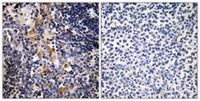 MCPH1 Antibody - Peptide - + Immunohistochemistry analysis of paraffin-embedded human thymus gland tissue using MCPH1 antibody.