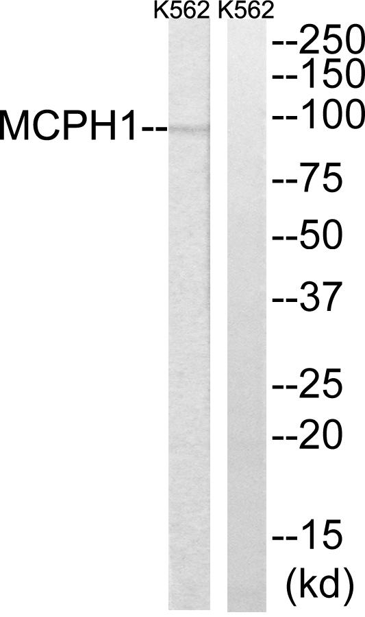 MCPH1 Antibody - Western blot analysis of extracts from K562 cells, using MCPH1 antibody.