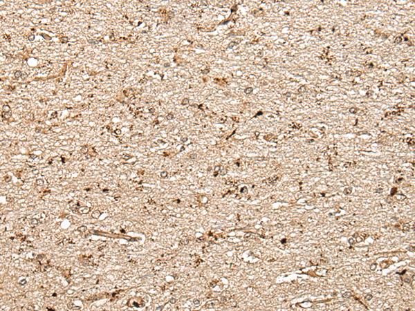 MCPH1 Antibody - Immunohistochemistry of paraffin-embedded Human brain tissue  using MCPH1 Polyclonal Antibody at dilution of 1:40(×200)