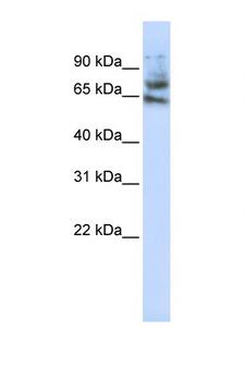 MCTP1 Antibody - MCTP1 antibody Western blot of Jurkat Cell lysate. Antibody concentration 1 ug/ml. This image was taken for the unconjugated form of this product. Other forms have not been tested.