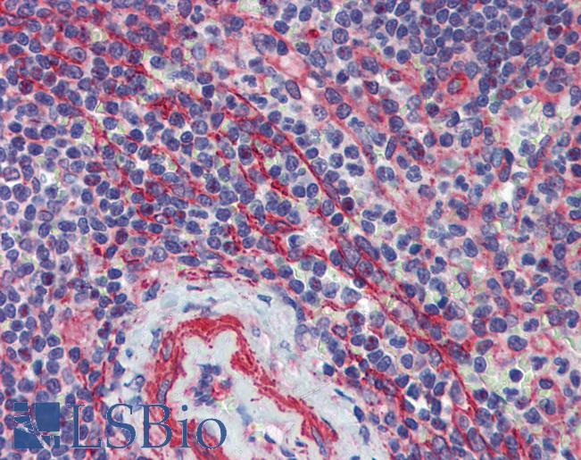 MCTP1 Antibody - Anti-MCTP1 antibody IHC of human spleen. Immunohistochemistry of formalin-fixed, paraffin-embedded tissue after heat-induced antigen retrieval. Antibody concentration 5 ug/ml.  This image was taken for the unconjugated form of this product. Other forms have not been tested.