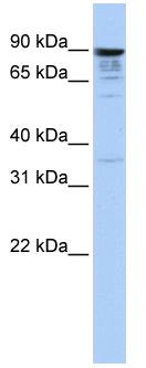 MCTP1 Antibody - Western blot of HeLa Cell Lysate.  This image was taken for the unconjugated form of this product. Other forms have not been tested.