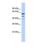 MCTP2 Antibody - Western blot of Human HeLa. MCTP2 antibody dilution 1.0 ug/ml.  This image was taken for the unconjugated form of this product. Other forms have not been tested.