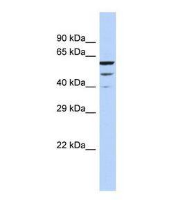 MCTP2 Antibody - Western blot of Human HeLa. MCTP2 antibody dilution 1.0 ug/ml.  This image was taken for the unconjugated form of this product. Other forms have not been tested.