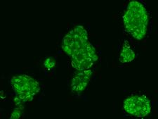 MCTP2 Antibody - Immunofluorescence staining of MCTP2 in RT4 cells. Cells were fixed with 4% PFA, permeabilzed with 0.1% Triton X-100 in PBS, blocked with 10% serum, and incubated with rabbit anti-Human MCTP2 polyclonal antibody (dilution ratio 1:200) at 4°C overnight. Then cells were stained with the Alexa Fluor 488-conjugated Goat Anti-rabbit IgG secondary antibody (green). Positive staining was localized to Nucleus and Cytoplasm.