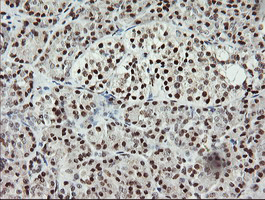 MCTS1 Antibody - IHC of paraffin-embedded Human pancreas tissue using anti-MCTS1 mouse monoclonal antibody.