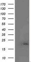 MCTS1 Antibody - HEK293T cells were transfected with the pCMV6-ENTRY control (Left lane) or pCMV6-ENTRY MCTS1 (Right lane) cDNA for 48 hrs and lysed. Equivalent amounts of cell lysates (5 ug per lane) were separated by SDS-PAGE and immunoblotted with anti-MCTS1.