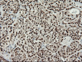 MCTS1 Antibody - IHC of paraffin-embedded Human pancreas tissue using anti-MCTS1 mouse monoclonal antibody. (Heat-induced epitope retrieval by 10mM citric buffer, pH6.0, 100C for 10min).
