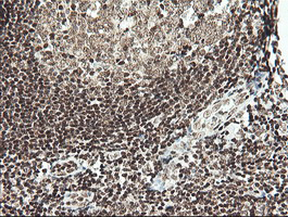 MCTS1 Antibody - IHC of paraffin-embedded Human tonsil using anti-MCTS1 mouse monoclonal antibody. (Heat-induced epitope retrieval by 10mM citric buffer, pH6.0, 100C for 10min).