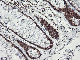 MCTS1 Antibody - IHC of paraffin-embedded Human colon tissue using anti-MCTS1 mouse monoclonal antibody. (Heat-induced epitope retrieval by 10mM citric buffer, pH6.0, 100C for 10min).