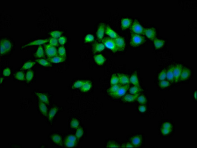MCTS1 Antibody - Immunofluorescence staining of PC-3 cells with MCTS1 Antibody at 1:266, counter-stained with DAPI. The cells were fixed in 4% formaldehyde, permeabilized using 0.2% Triton X-100 and blocked in 10% normal Goat Serum. The cells were then incubated with the antibody overnight at 4°C. The secondary antibody was Alexa Fluor 488-congugated AffiniPure Goat Anti-Rabbit IgG(H+L).