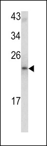 MCTS1 Antibody - Western blot of MCT-1 antibody in mouse bladder tissue lysates (35 ug/lane). MCTS1 (arrow) was detected using the purified antibody.